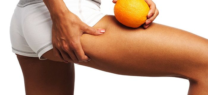 consejos para reducir la celulitis